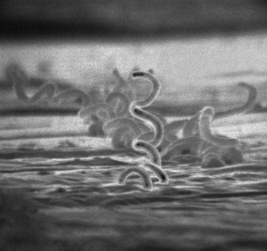 Electron micrograph of Treponema pallidum, Public Health Image Library, U.S. CDC