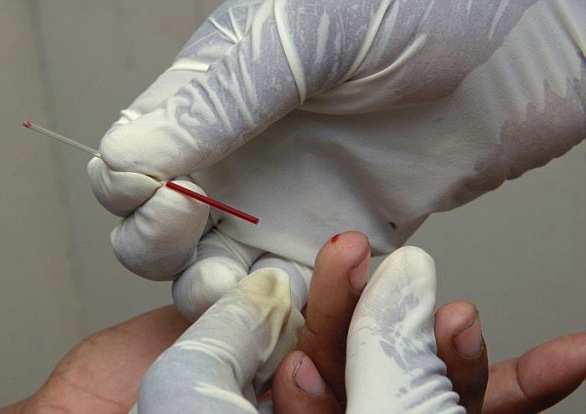 Other rapid tests on the market analyze a finger-prick blood samples